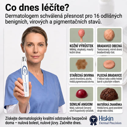 Oficiální značkový obchod | Hiskin® 7denní odstraňovač skvrn a pigmentových skvrn (Bezbolestný rollerball bez jizev)🐬