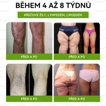 🎁 Zbývá jen 5 balení! Získejte nyní 50% slevu! Nepropásněte dnešní nabídku!