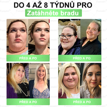 🎁 Zbývá jen 5 balení! Získejte nyní 50% slevu! Nepropásněte dnešní nabídku!