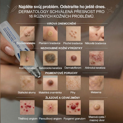 Oficiální značkový obchod | Hiskin® 7denní odstraňovač skvrn a pigmentových skvrn (Bezbolestný rollerball bez jizev)🐬