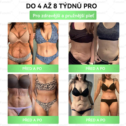 🎁 Zbývá jen 5 balení! Získejte nyní 50% slevu! Nepropásněte dnešní nabídku!
